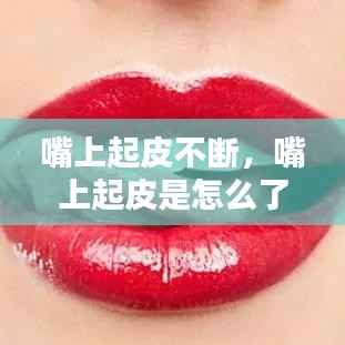 嘴上起皮不断,嘴上起皮是怎么了