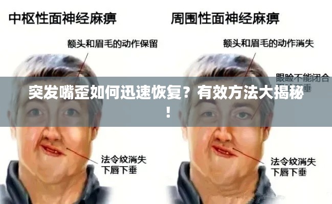 突发嘴歪如何迅速恢复?有效方法大揭秘!