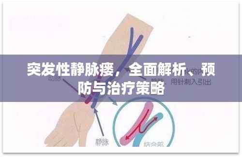 突发性静脉瘘，全面解析、预防与治疗策略